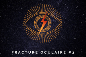 fracture oculaire 2